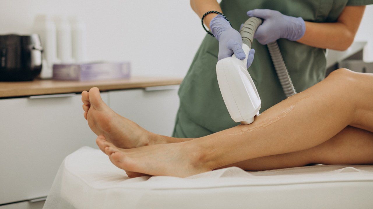 Laser Hair Removal